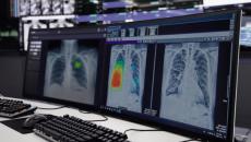 Two computer units showing the Lunit INSIGHT CXR