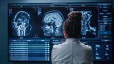 Healthcare provider looking at brain scan images