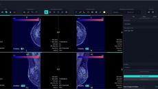  An interface of FxMammo, the AI breast cancer screening support solution by FathomX